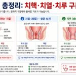 치질 총정리: 치핵·치열·치루 구분법
